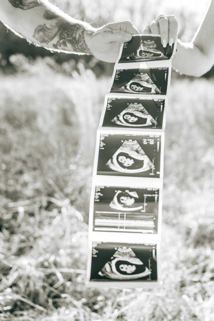 Candid maternity photography of expecting couple